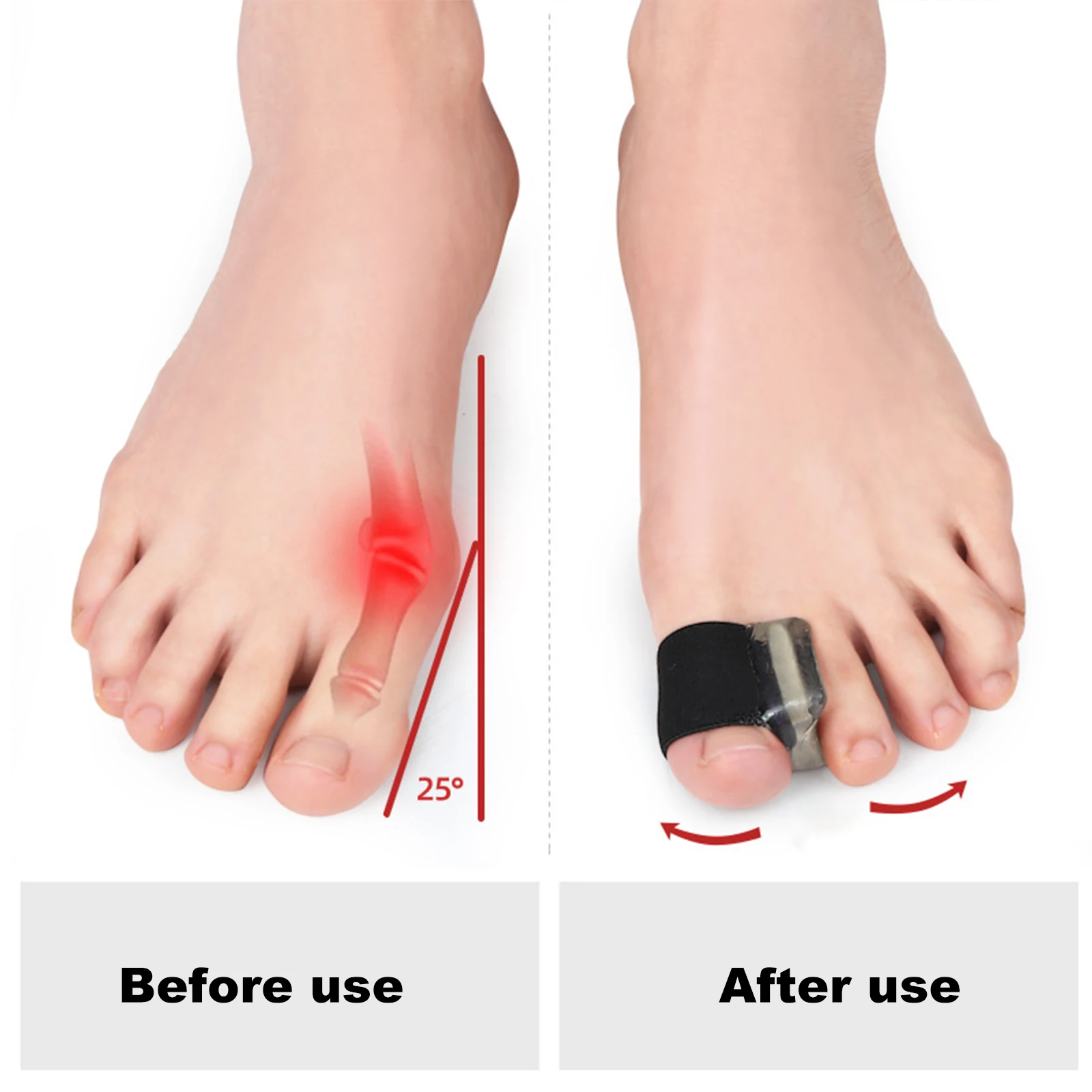 ซิลิโคนเจล Thumb Corrector Bunion Foot Toe Hallux Valgus Protector Separator Finger Straightener Adjuster Foot Care TOOL