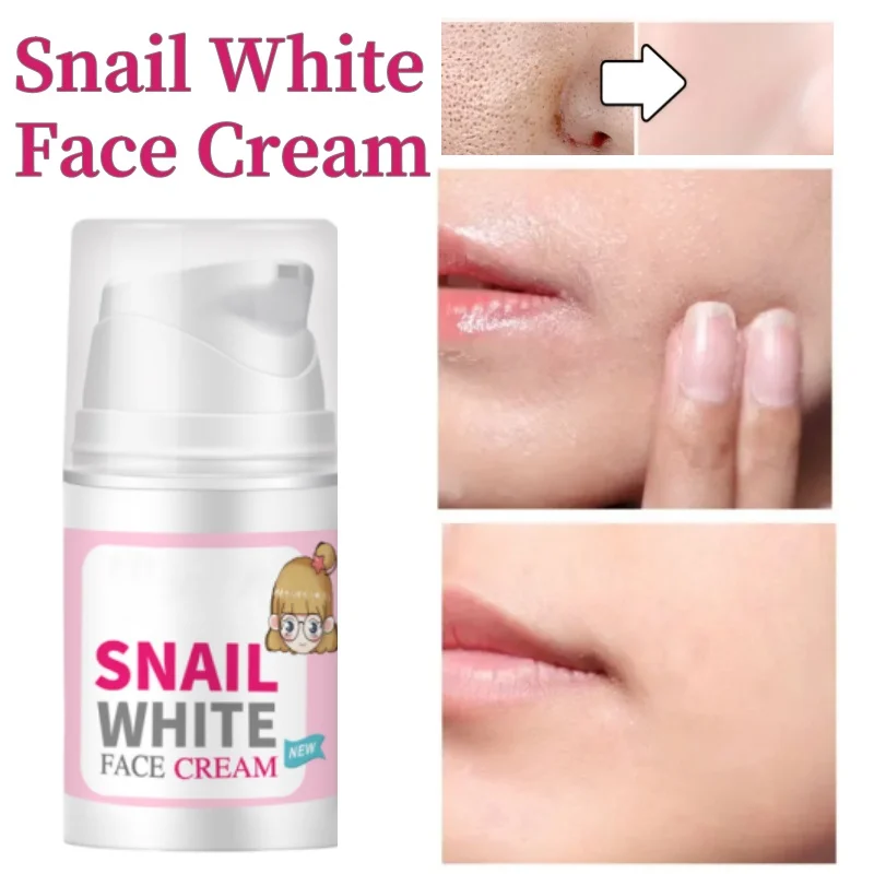 

Nicotinamide Brighten Cream Pore Shrinking Quickly Eliminate Large Pores Remove Blackheads Tighten Face Smooth Skin Safe Care