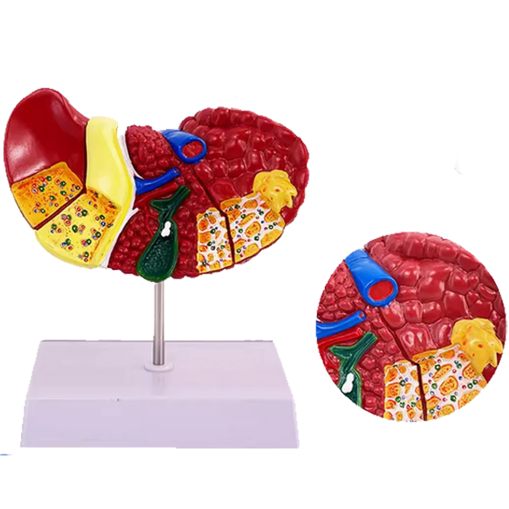 Medical Science Colored Pathology Liver Anatomical Model