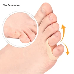 Silicone Gel Toe Corrector, Feet Care, alisadores, sobreposição Separadores, Hallux Valgus, Bunion Aliviar a dor, Protector, 1 par