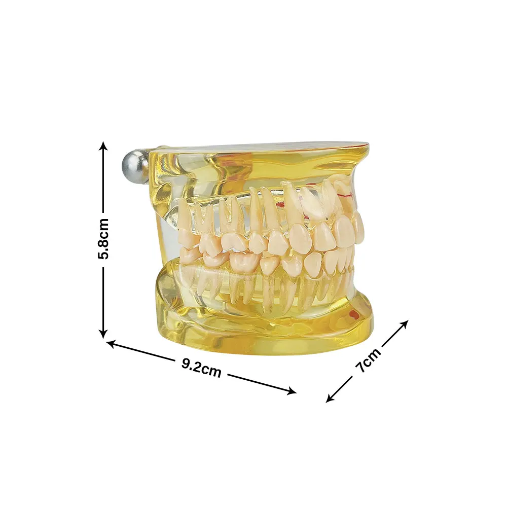 Dental Teeth Model With Removal Teeth  Clear Jaw Model Dentistry Pathology Dental Models For Patient Education Studying Teaching