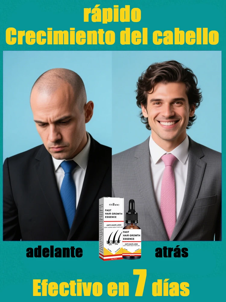 

Hot sale, buyers will buy again, hair is getting more and more, say goodbye to baldness, sparse hair starts to become thick
