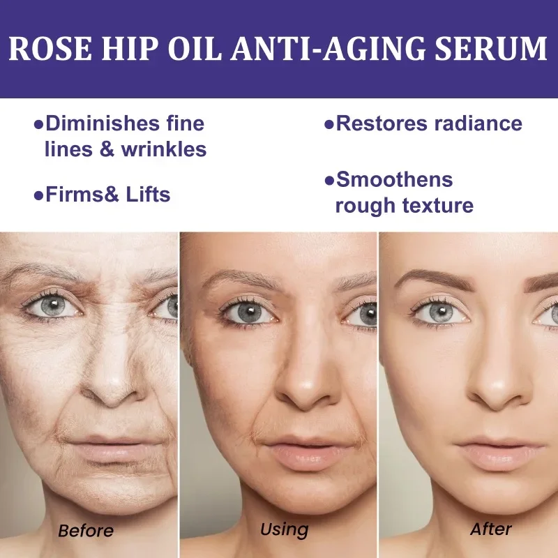 Rosehip oil facial essence remove Dark spots fade  fine lines anti wrinkle aging firming whitening moisturizing skin care Serum