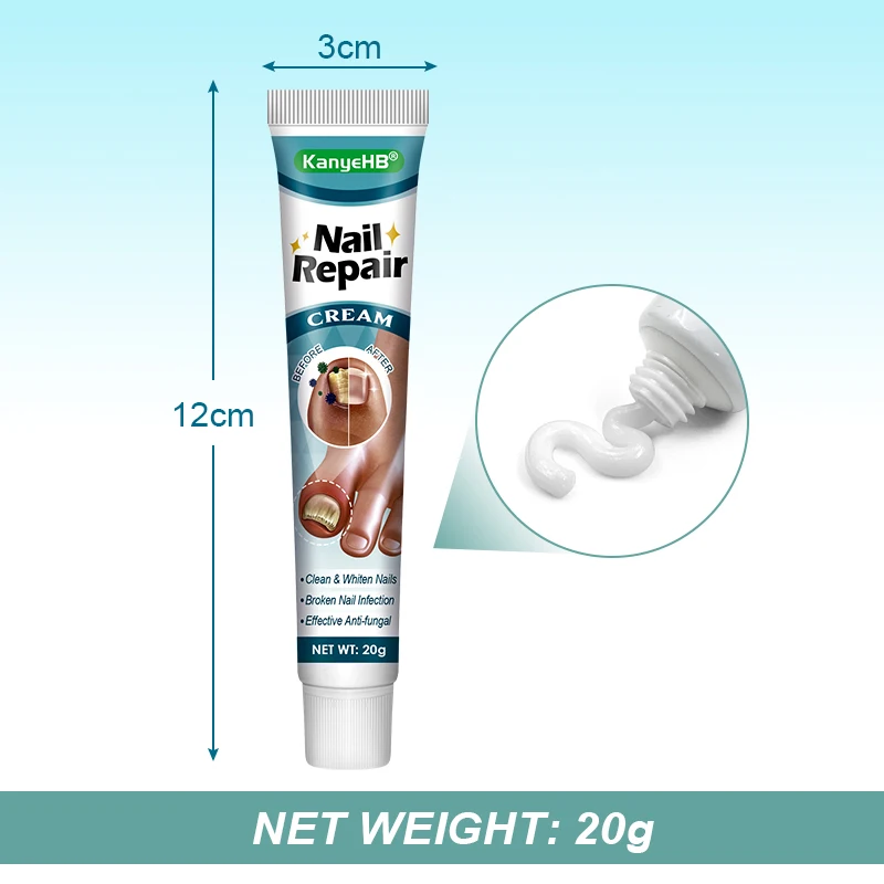 1pcs Nail Antibacterial Cream Nail Fall Off Nail Discoloration Onychomycosis Treatment Cream Toes Nail Fungus Removal Cream G048