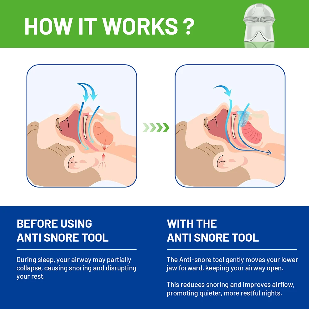 أجهزة مكافحة الشخير، حل مريح للشخير، سدادة أجهزة فعالة للشخير للرجال والنساء #2
