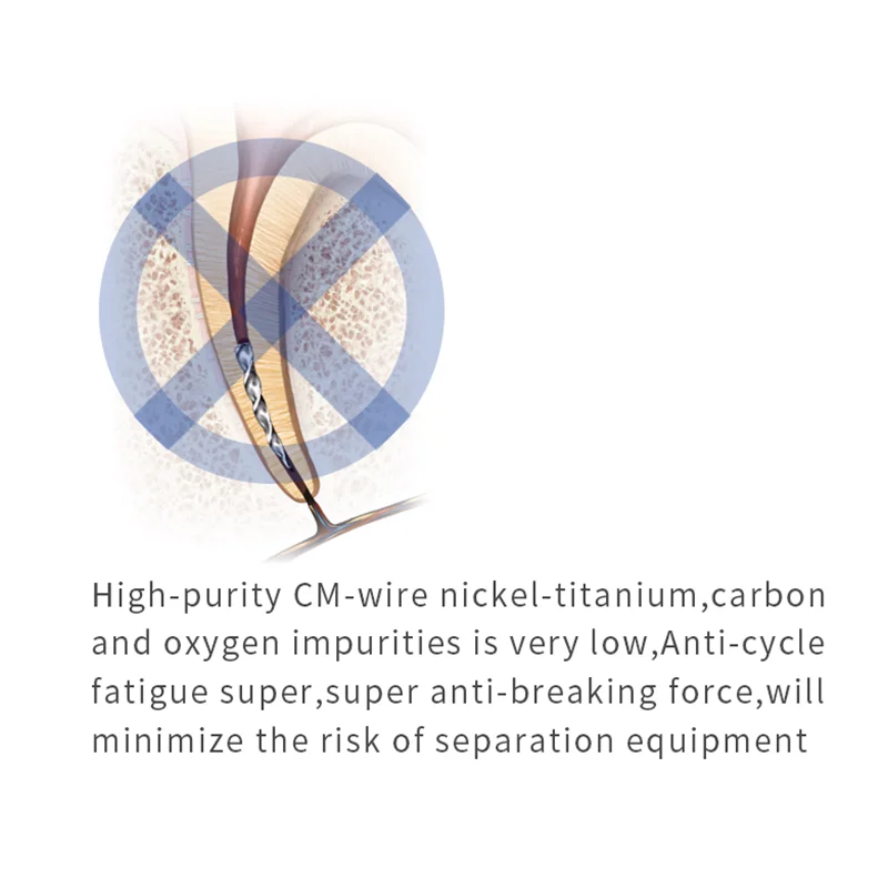6 ชิ้น/กล่อง SOCO ทันตกรรม Endo ไฟล์ Root Canal Taper Endodontic แฟ้ม Niti ความร้อนเปิดใช้งานแฟ้มโรตารี่ยืดหยุ่นเครื่องมือทันตแพทย์