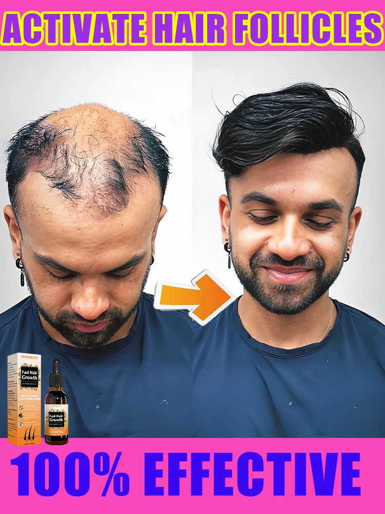 Densificazione dei capelli, crescita rapida, densificazione dei capellicrescita rapidadispositivo anti-stripping maschile e femminile