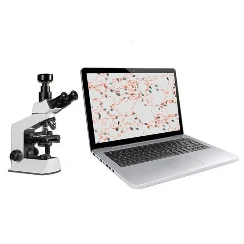 Biological Microscope Clinical Medical Automatic Software Semen Sperm Analyzer for Human and Vet