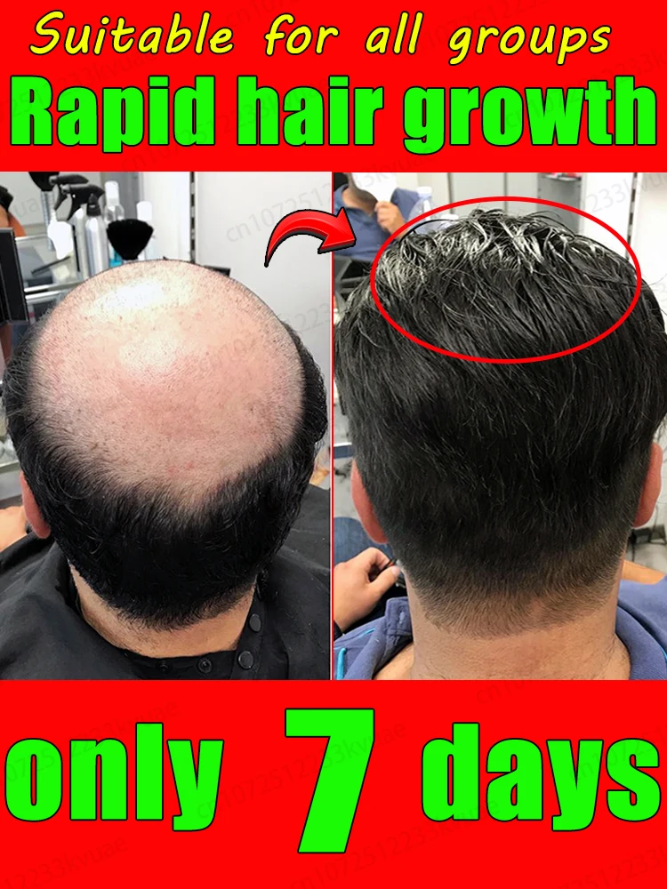 

You can get rid of hair loss and baldness in 7 days. The hair growth essential oil in the little blue bottle is an essential oil