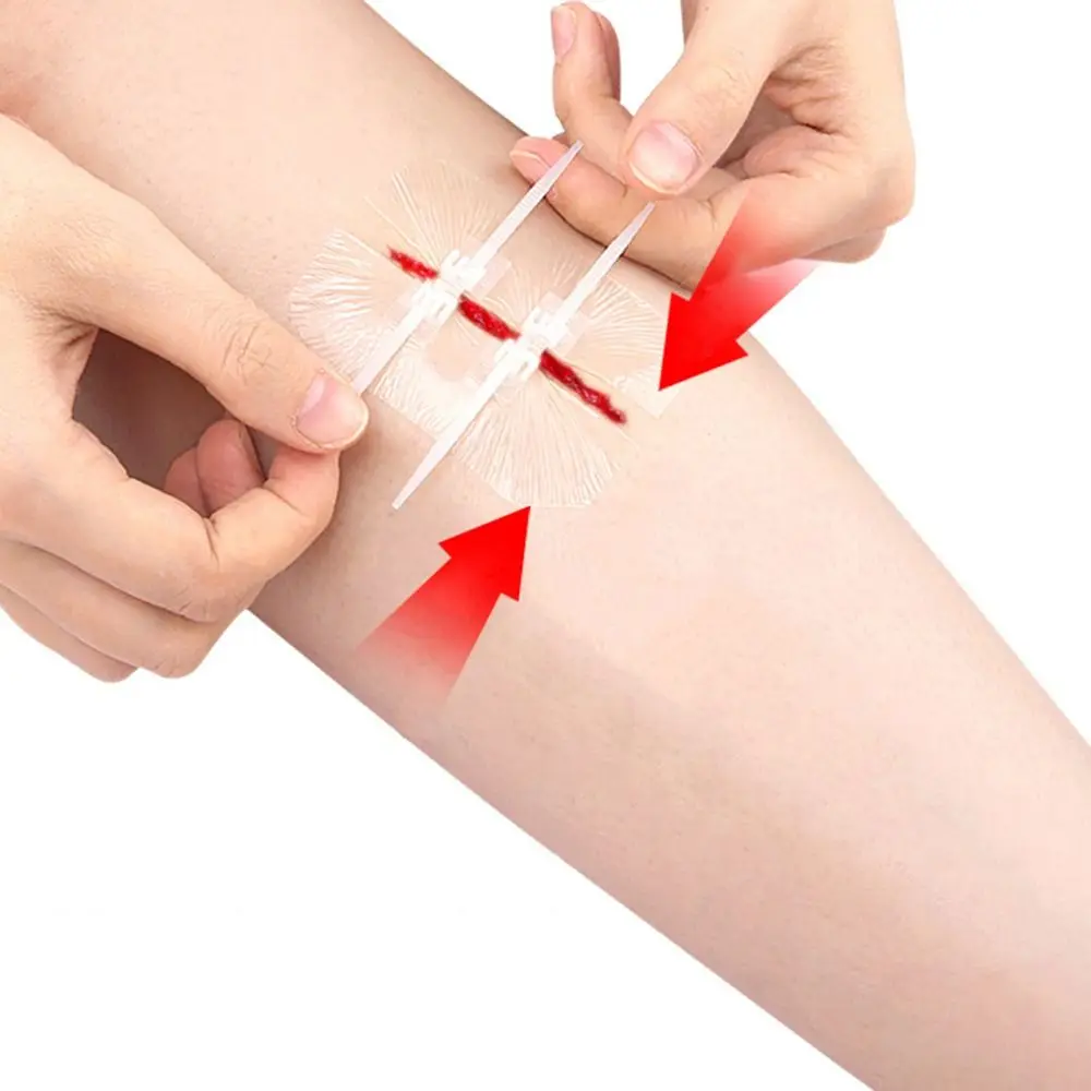 

Adhesive Wound Care Zip Sutures Bandaids Without Stitches Emergency Emergency Wound Closures First Aid Laceration Closures