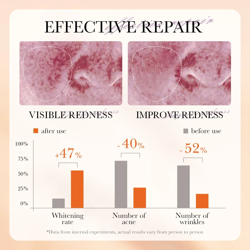 مقشر مرطب يزيل الجلد الميت ويعزز الترطيب ويصلح حاجز الجلد #2
