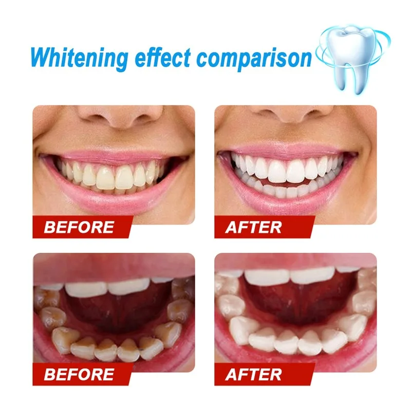 Teeth Whitening Essence Serum Bleach Powder Oral Hygiene Cleansing Remove Plaque Stains Fresh Breath Dentistry Dental Tools