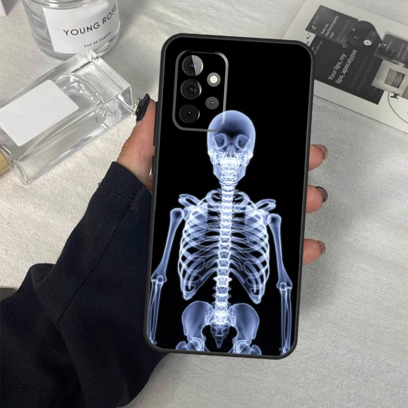 Radiological Human Organs Skeleton Case For Samsung Galaxy A14 A24 A34 A54 A51 A71 A13 A23 A33 A53 A73 A12 A22 A32 A52 Coque