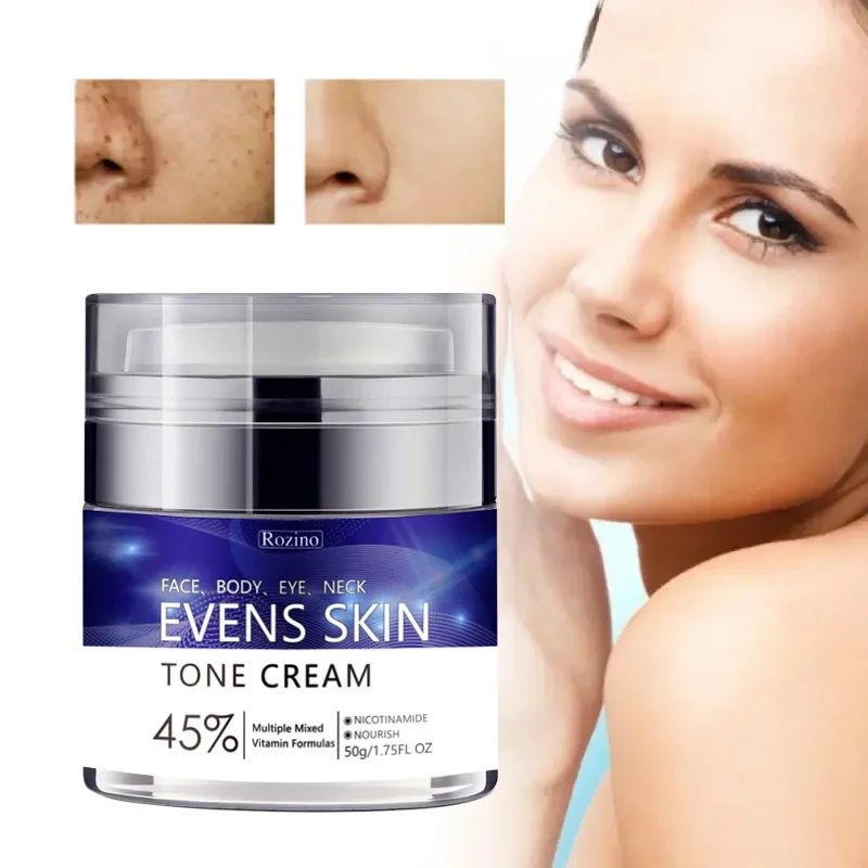 Dark Spot Correction Cream Lightens Melanin and Brightens Skin Color Press face cream Body Cream