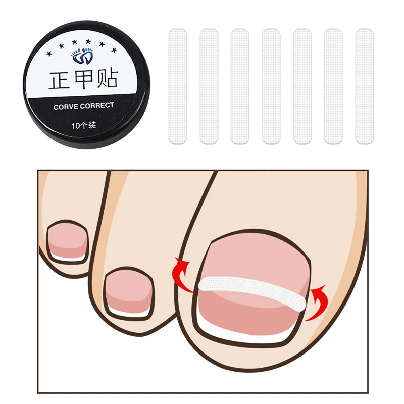 Traitement des ongles incarnés, outil de Correction des ongles incarnés, Patch élastique autocollant, Clip de redressage, attelle, outils de pédicure, 10 pièces
