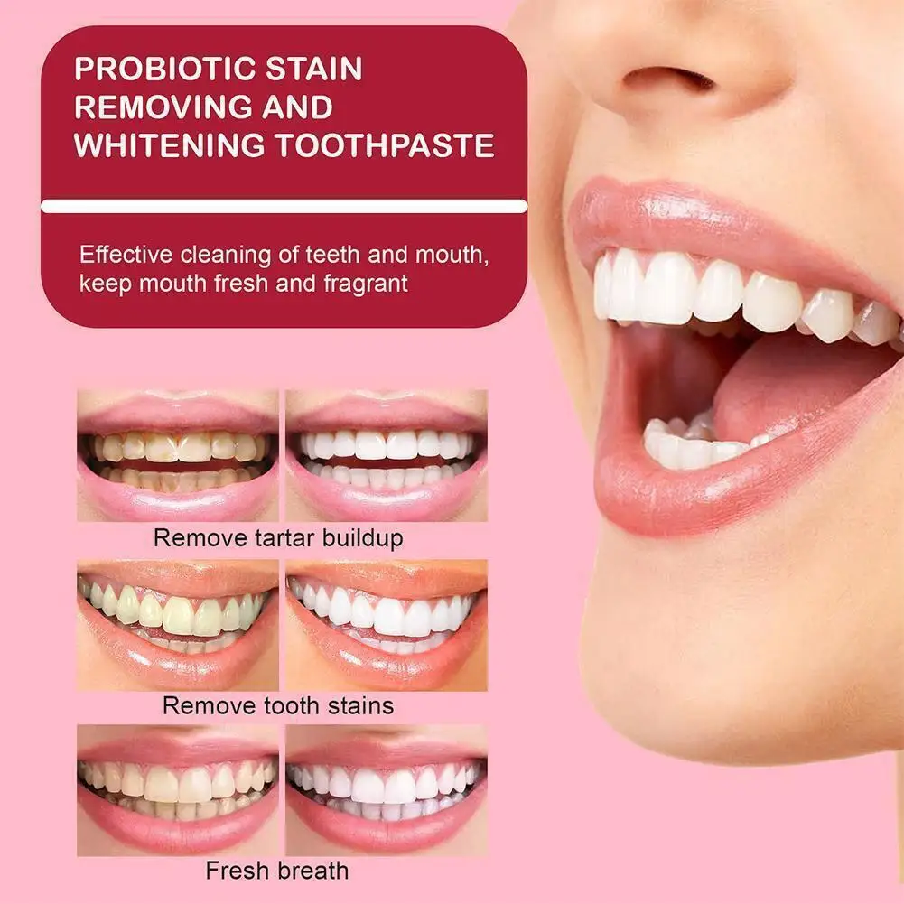 Probiotische Whitening Tandpasta Verwijderen Tandplak Vlekken Gele Tand Verse Adem Beschermt Tandvlees Tand Bleking Reparatie Tools 120G