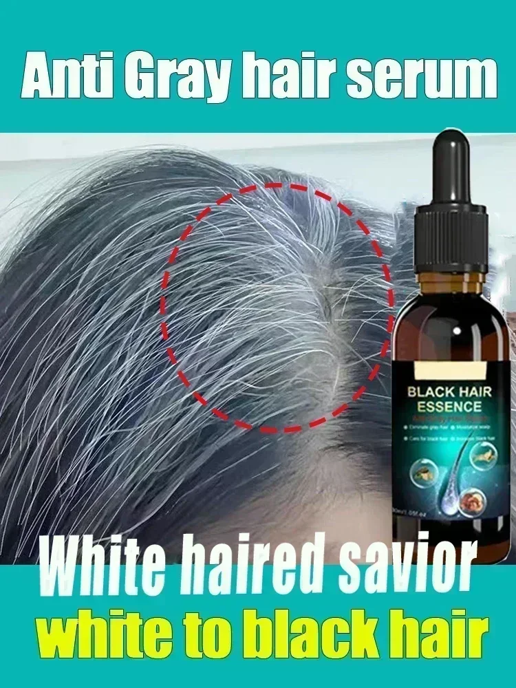 Sdotter New Anti-Greying Hair Serum Anti-Greying Repair Serum Hair Lotion Liquid Herbal White To Black Hair Care Products Care