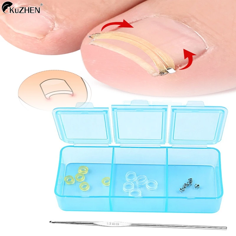 1Set Ingrown Toenai…