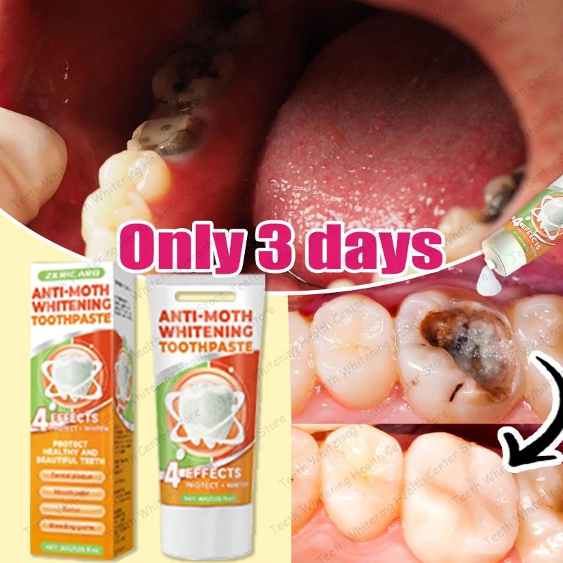 

Repair tooth decay, effective and healthy