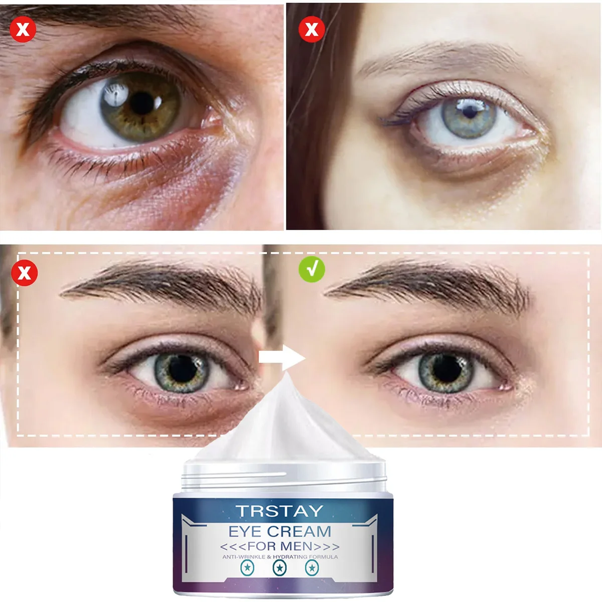 

TRSTAY крем для глаз против морщин, увлажняющий, против старения, укрепляющий, лифтинг, отбеливающий уход за кожей для мам и детей