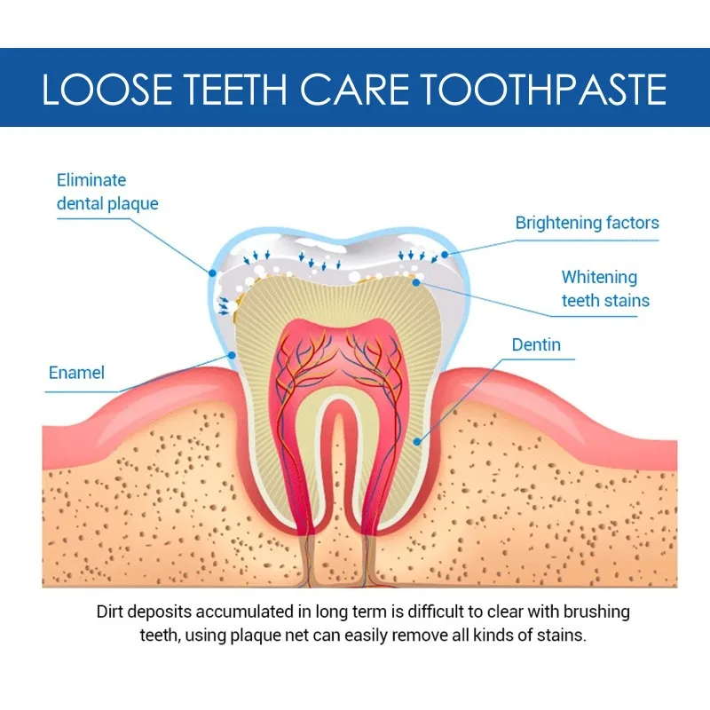 Pulizia dei denti dentifricio sbiancante efficace denti gialli rimozione della placca macchia dei denti cura della pulizia dentale cura del respiro fresco