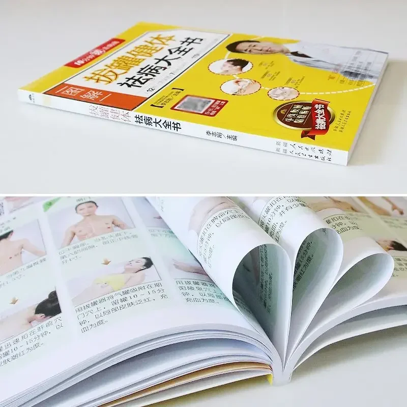 Schröpfen Gesundheit Körper Entfernung Buch Illustrierte TCM Akupunkturpunkt Null-basierte Schröpfen Einführung Schröpfen Technik Tutorial