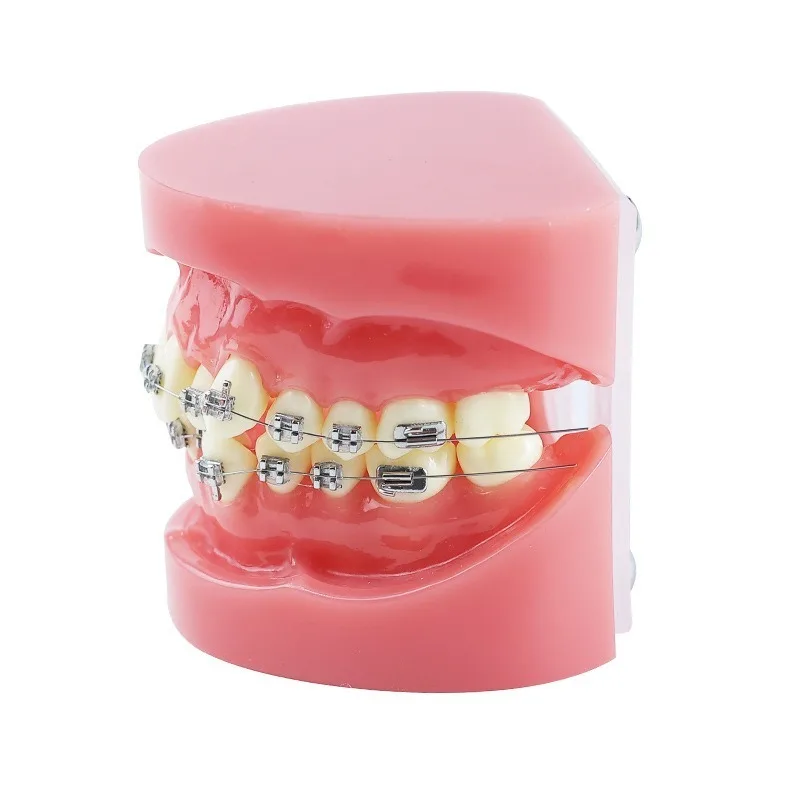 Orthodontic dislocation orthodontic model oral teaching bracket correction