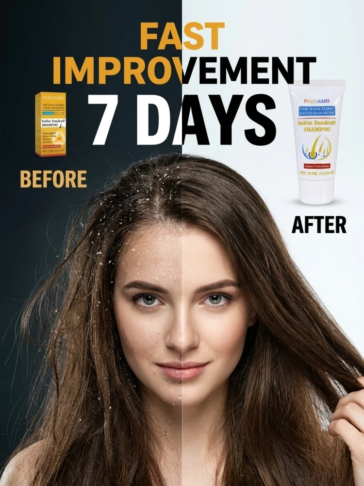 Daily‑Use Sulfur Hair Shampoo, Deep Mild Scalp Cleansing, Lessen Noticeable Dandruff, Ease Discomfort Of Scalp, Reinforce Fragile Hair Roots, Reduce Broken Hair & Hair‑Shedding Appearance for Unisex At‑Home Hair Washing Routine