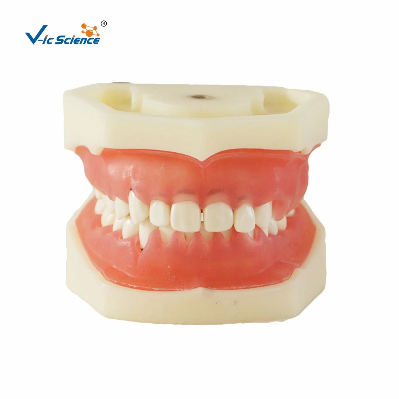 High Quality Periodontal Disease Model