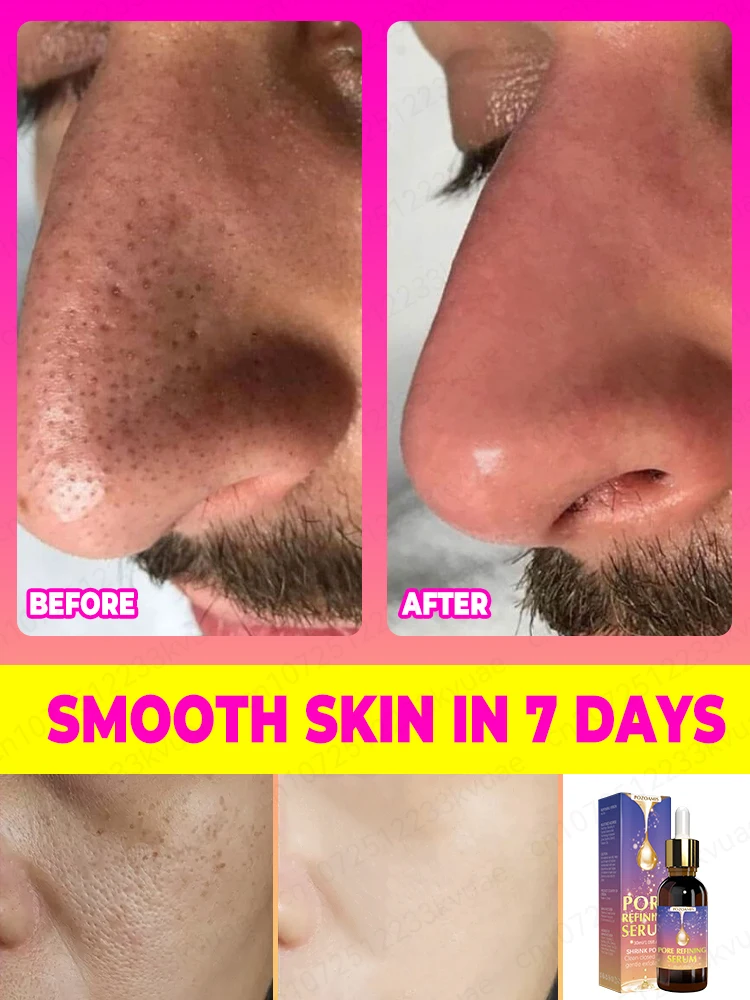 Pore shrinking essence, lighten pores, remove wrinkles, and restore 18-year-old skin