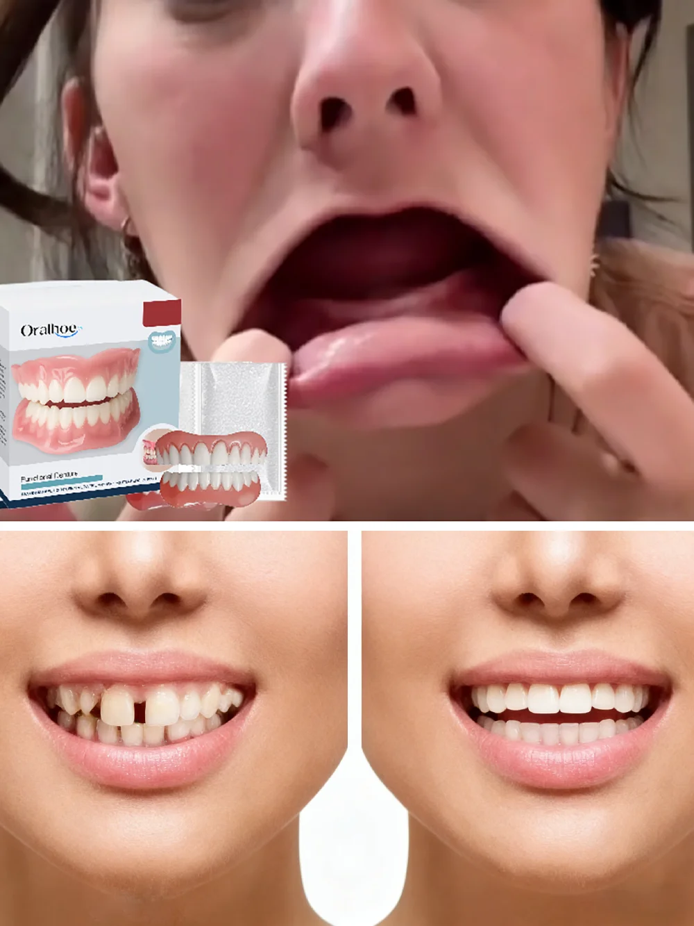 protesis-dentales-para-mujeres-y-hombres-faciles-de-usar-naturales-seguras-profesionales-dientes-postizos-kit-de-modificacion-de-protesis-practico-y-conveniente