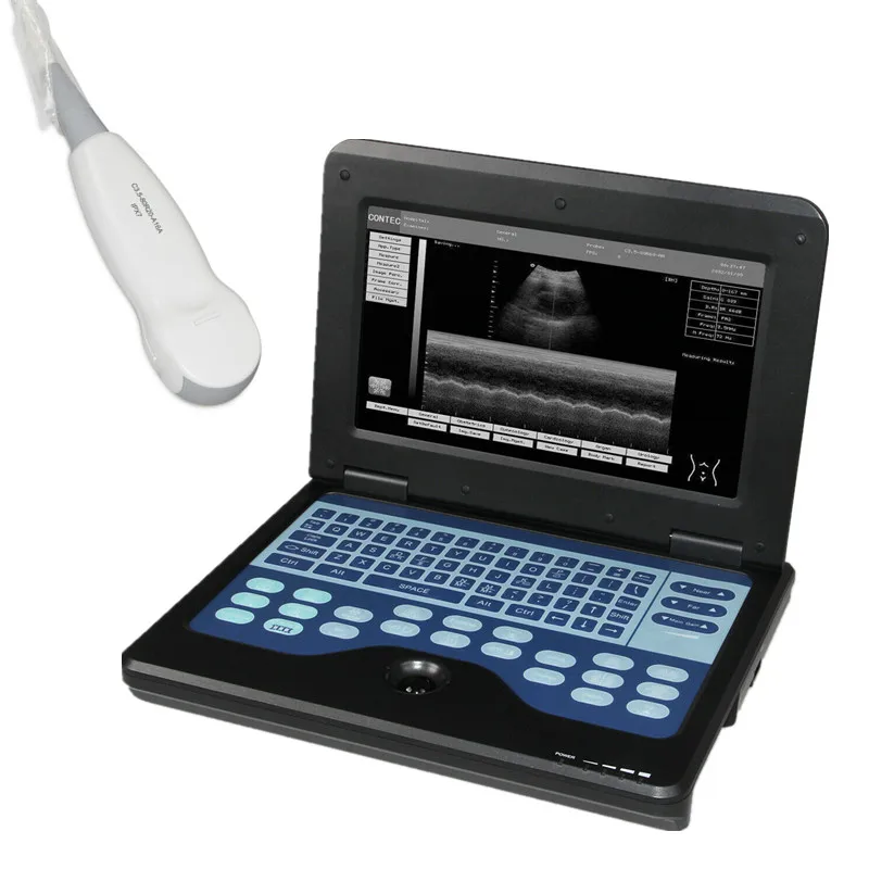 CONTEC CMS600P2 ultrasound scanner laptop machine ultrasonic diagnostic systems with Micro Convex probe