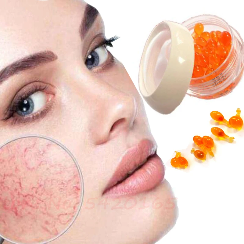 Facial Varicose Vein Essence Anti Redness Spider Vein Remover Advanced Treatment Clearer Skin Veins Whitening And Moisturizing