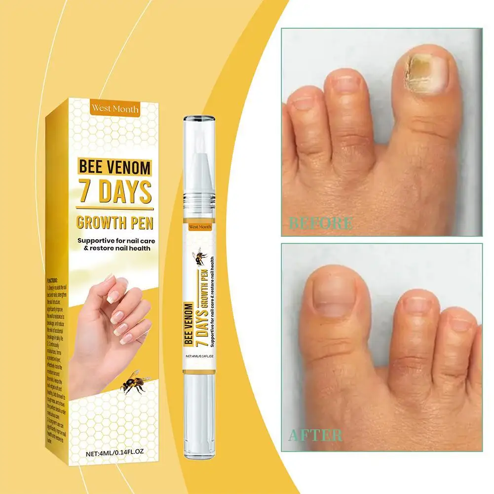 4ml serum inhibits fungus and repairs nails Nail Liquid Nail Care Liquid Soft Nail Paste Onychomycosis Liquid