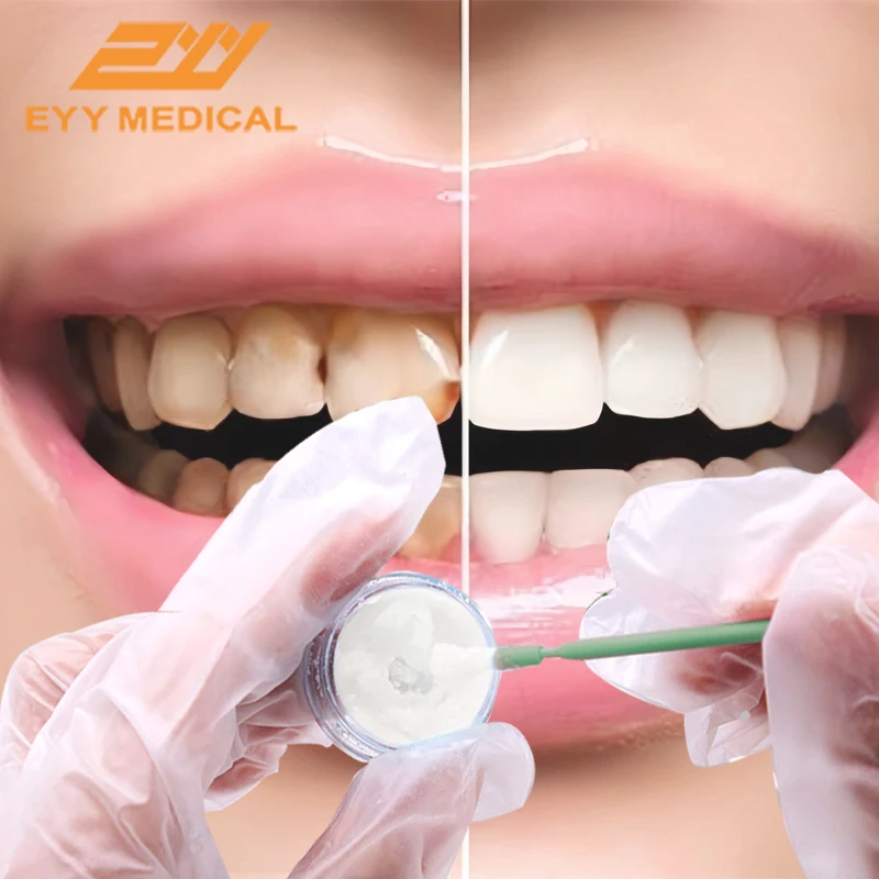 

EYY Tooth Whitener Gel Teeth Whitening Products Brighteni Teeth Whitening Peroxide Dental Bleaching Oral Gel Kit Resin Companion