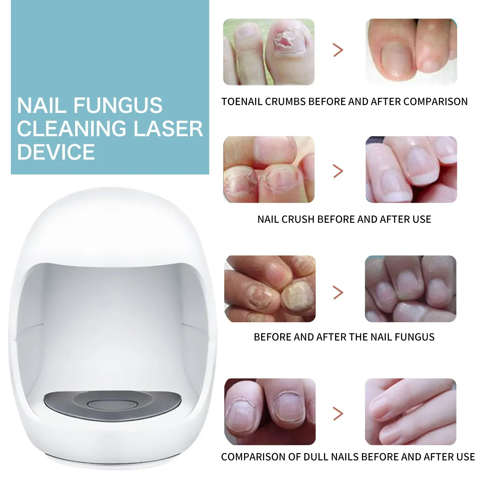 Fungal Nail Laser Device Repair Fast Nails Fungus Onychomycosis Treatment Cold Laser Physical Therapy Toenail Laser Device