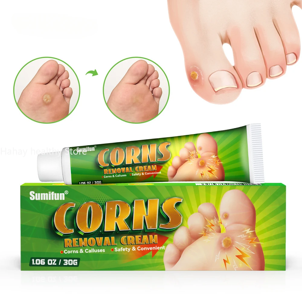 Foot Corn Remover Cream Chicken Eye Skin Infection Treatment Ointment Feet Dead Skin Calluses Removal Tool Health Care 내성발톱