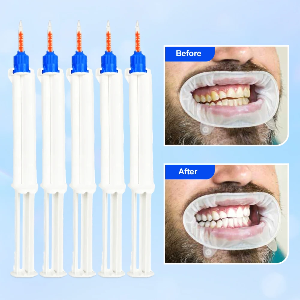 

5pcs /1pcs Dual Barrel Syringe Teeth Whitening Gel Double Barrier Dental Supplies Bleach Tooth Whitener Gel