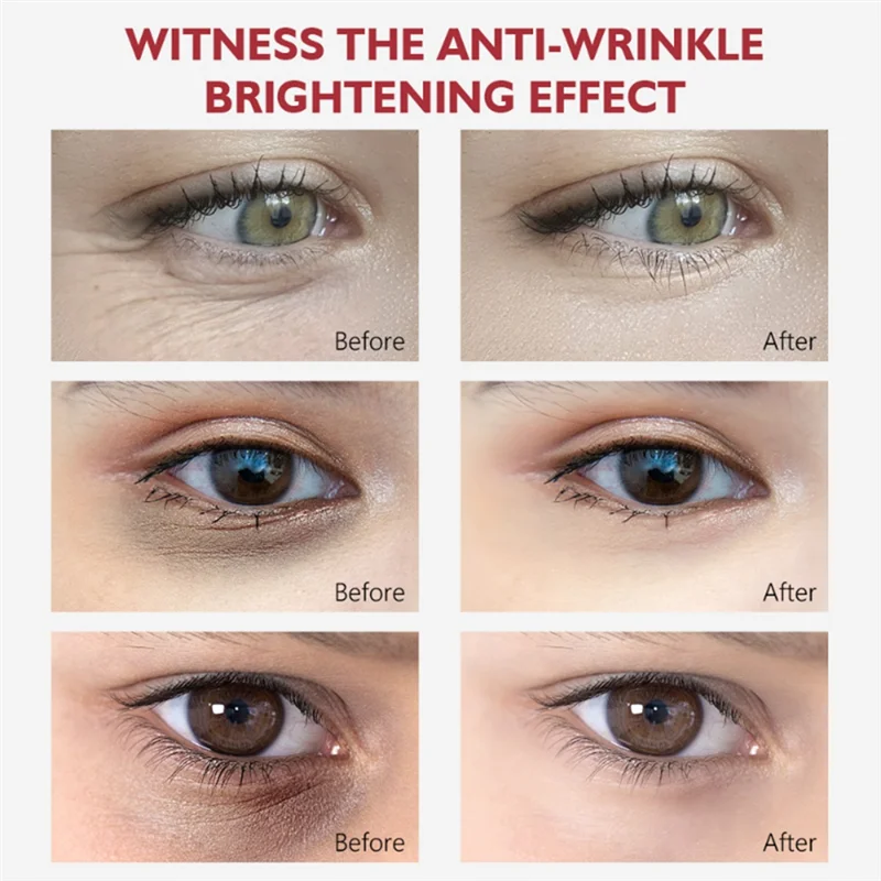 Nicotinamide Eyes Cream Dark Circles Remove Eye Bags Under Eye Acid Moisturizing Serum Against Puffiness Eye Care Gel