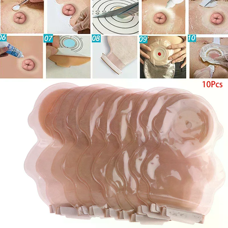 /YOV/Pediatric Sticky Closure One-piece Drainable Colostomy Bag Stoma Care Bags 10Pcs