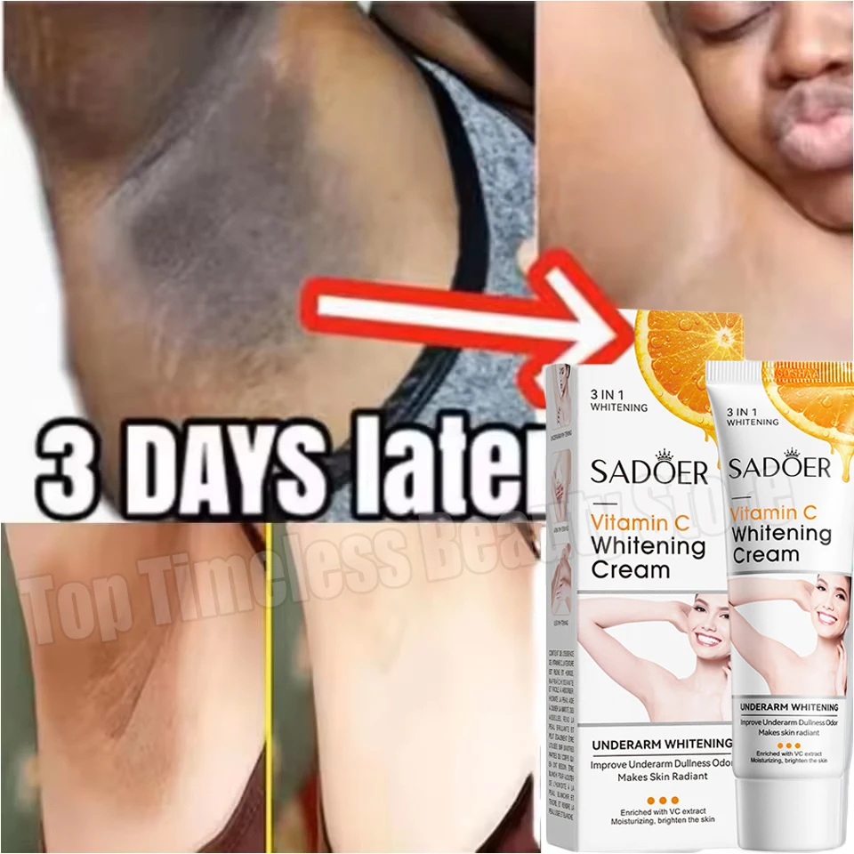 Crema blanqueadora para axilas y cuerpo, 50g, partes privadas, blanqueamiento, glaseado, glúteos, rodilla, ilumina la parte interna del muslo, íntimo, oscuro, elimina la melanina