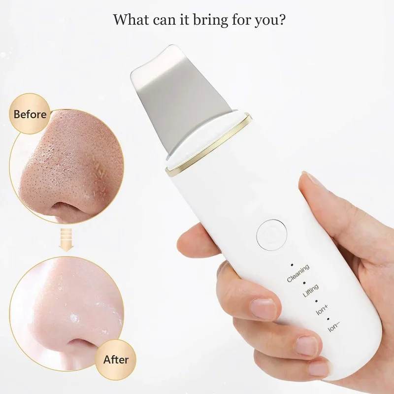 Ultrasonic Skin Scrubber Peeling Blackhead Remover Deep Face Cleaning Ultrasonic Ion Acne Pore Cleaner Facial Shovel Cleanser