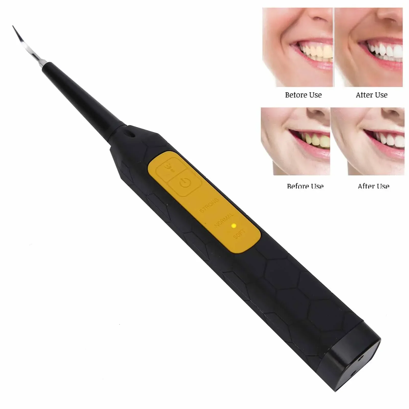 HighQuality Stainless Steel Head Tooth Cleaner Electric Calculus Remover Portable Teeth Tartar Remover Oral Care Tool USB Charg