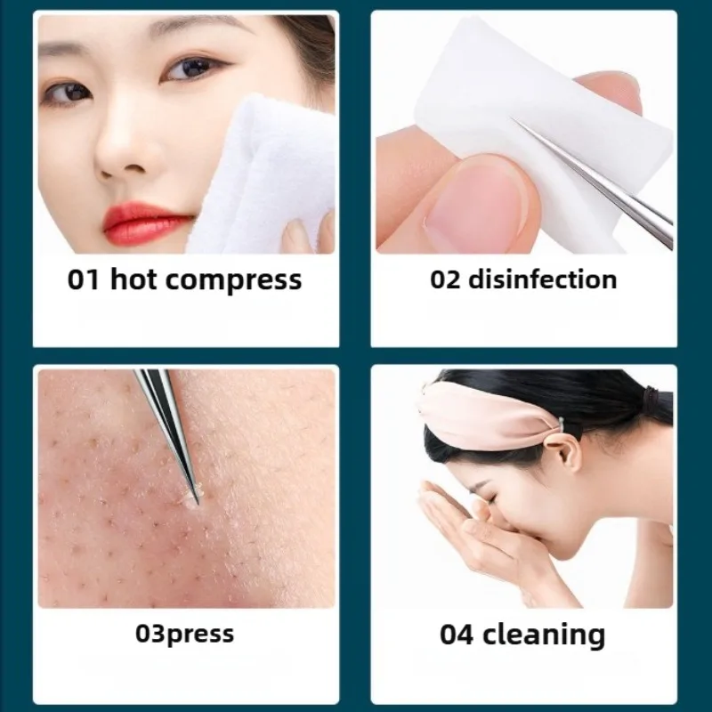 3/8 kit removedor de cravo de aço inoxidável mancha acne ferramentas de extração profissional espinha popper conjunto cuidados faciais ferramentas beleza