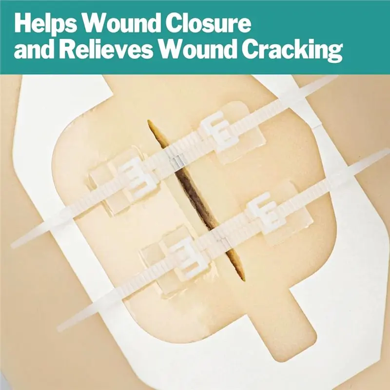 [B24B!】 Emergency Wound Closure Strips Quick Clot Zip Device