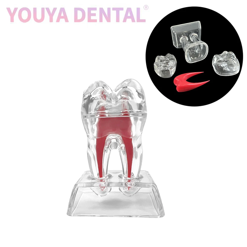 1 Pcs Dental Model Removable Transparent Tooth Anatomy Molar Model Suitable For Dentist Teaching Learning Clinic Decoration