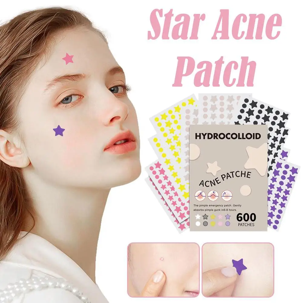 600 Stuks Grote Ster Acne Patch Mild Niet-Irriterend Verlicht Acne Voor Mee-Eters Gesloten Comedonen Hydrocolloïde Acne Sticker