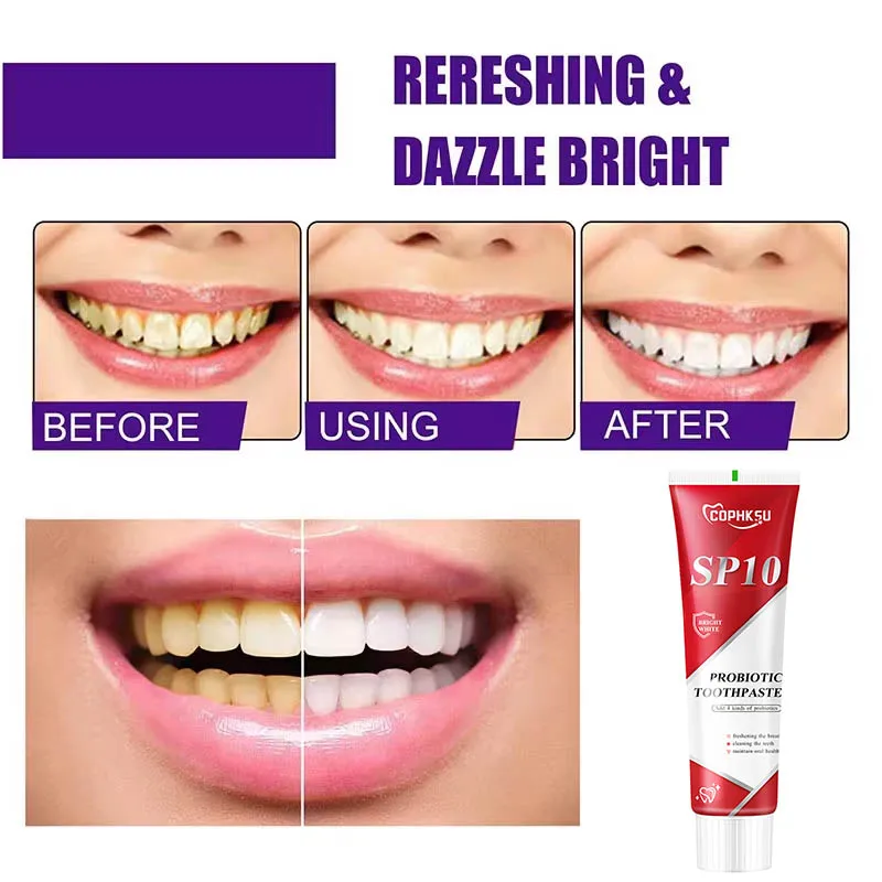 Sp-10 Fresh Breath Teeth Whitening Remove Yellow Plaque Stains Relieve Gums Decay Toothpaste Oral Health Care Management 2024