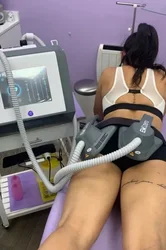 Máquina de adelgazamiento Tesla DLS-EMSSLIM NEO, electroestimulación muscular para pérdida de peso, electroestimulación corporal, construcción de glúteos, EMSZERO 2024, 14