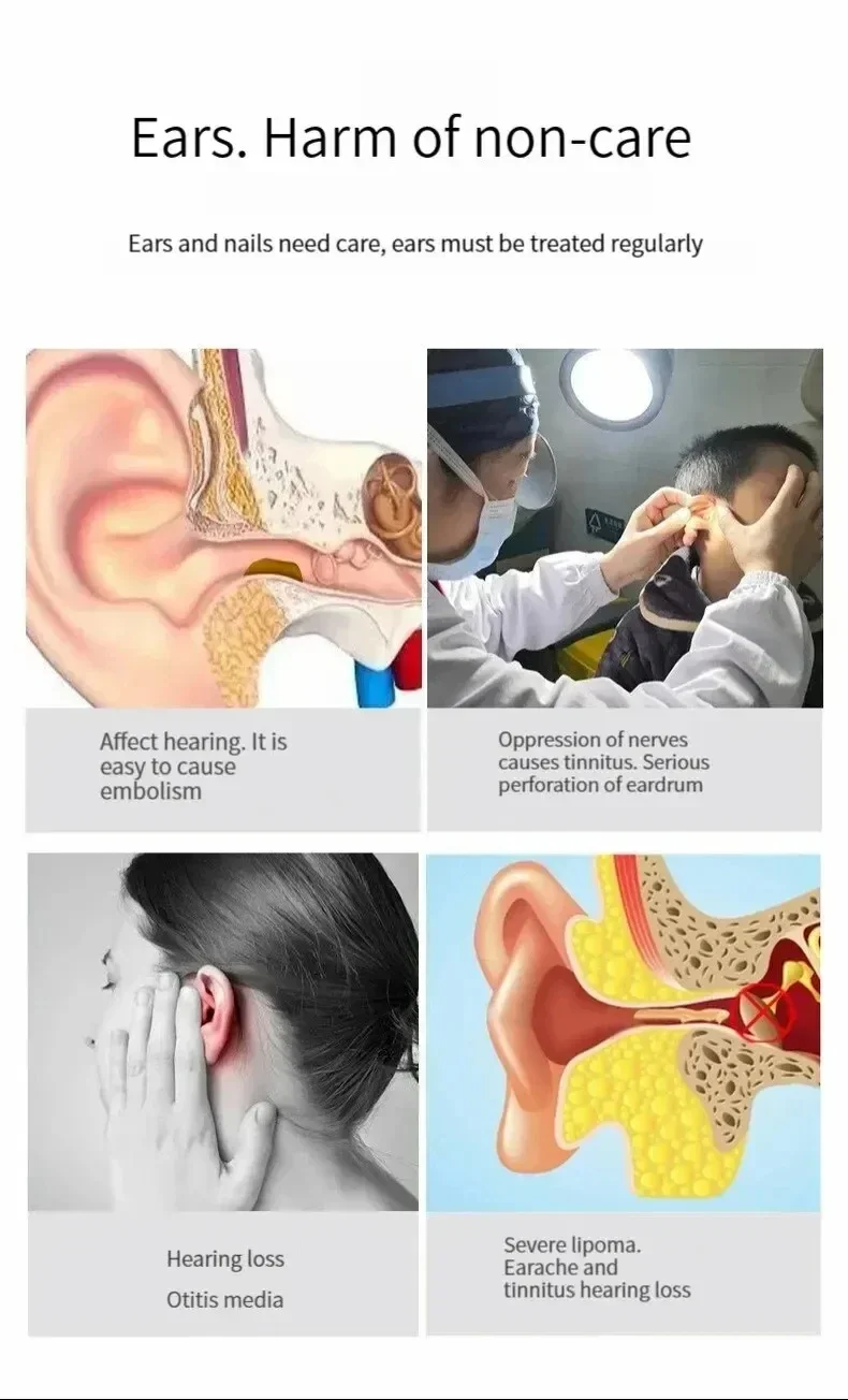 TINSOL Smart HD Visueller Ohrenreiniger 1080P Ohrenschmalz-Entferner Otoskop USB-C Wiederaufladbares Endoskop Ohrenschmalz-Reinigungswerkzeug Gesundheitspflegeset – Detail 4